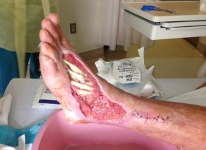 black sports online horrific man vs wild snake bite