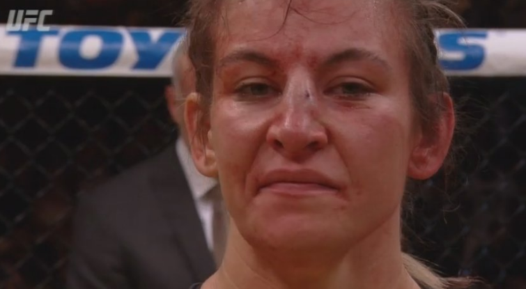 Miesha-Tate-UFC-200-Broken-Nose.png