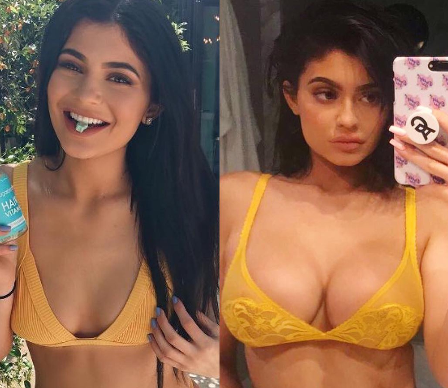Kylie Jenner Shows Off New Store Bought Boobs on Instagram (Photos) .