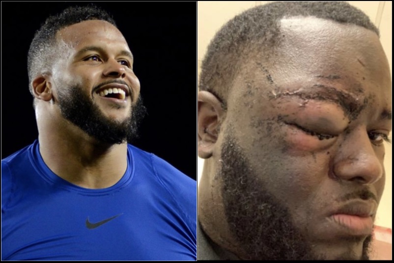 Surveillance Video Proves DeVincent Spriggs Attacked Aaron Donald With a  Bottle Before Getting Beat Down | BlackSportsOnline