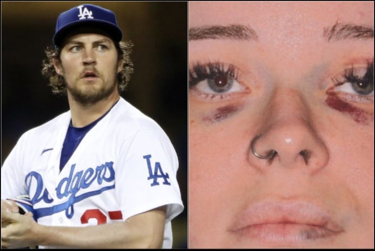 Trevor Bauer Sues Assault Accuser Lindsey Hill For Trying To Destroy