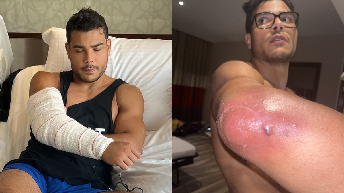 ‘Hide Injuries’- Paulo Costa Reveals How Fighters Hide Their Injuries