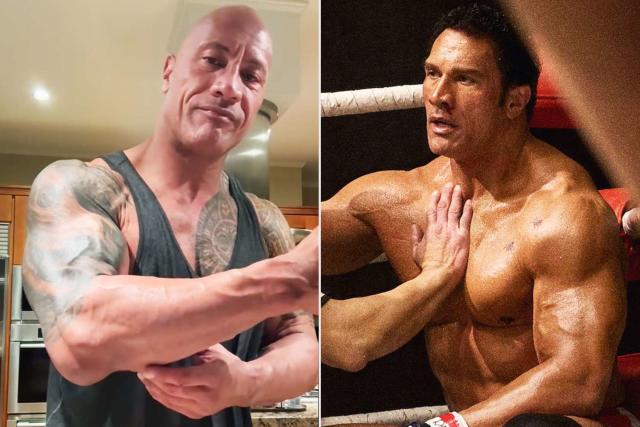 The Rock Shows a Horror Elbow Injury Sustained During “The Smashing Machine” Filming