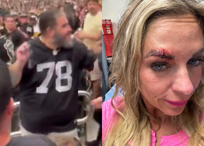 VIDEO: Raiders Fan Arrested For Attacking Female Steelers Fan Jen Mascaro Who Ended Up In The Hospital