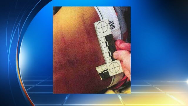 Adrian Peterson Switch 1