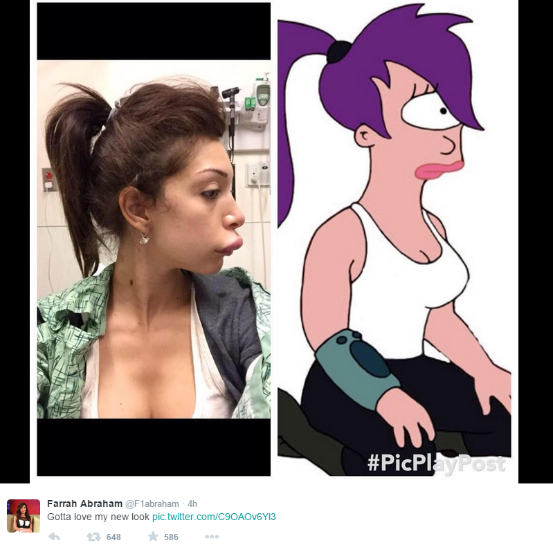 Farrah Abraham Lips 2